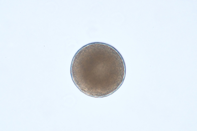 Moule (Mytilus edulis) - Cellule-oeuf x70